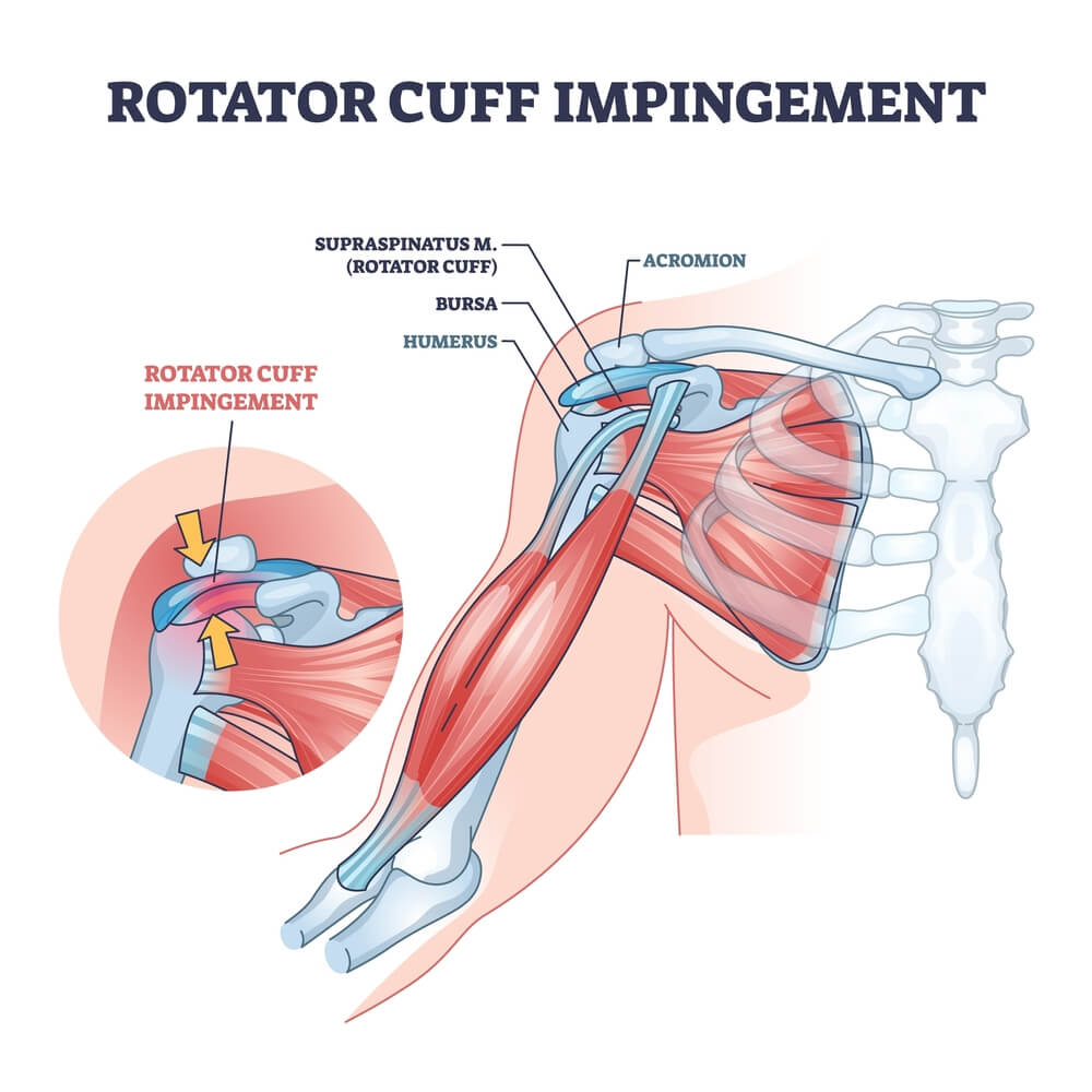 Rotator Cuff